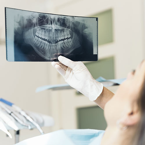 dental xray